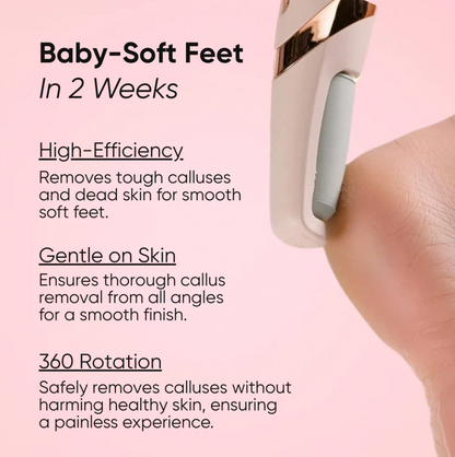 Softsteps- Foot Exfoliator & Callus Remover